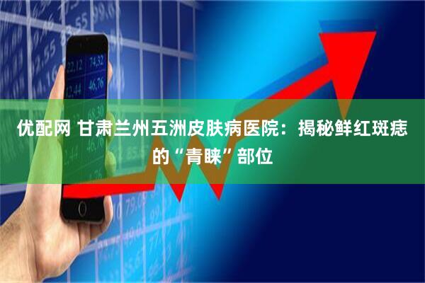 优配网 甘肃兰州五洲皮肤病医院：揭秘鲜红斑痣的“青睐”部位